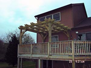 pergola